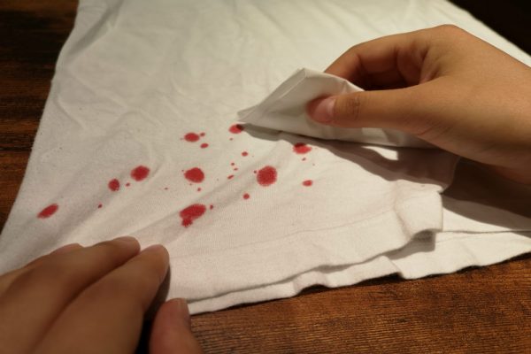 血液の洗濯は応急処置が効く 確実に染み抜きをする簡単な3つの方法 Yourmystar Style By ユアマイスター